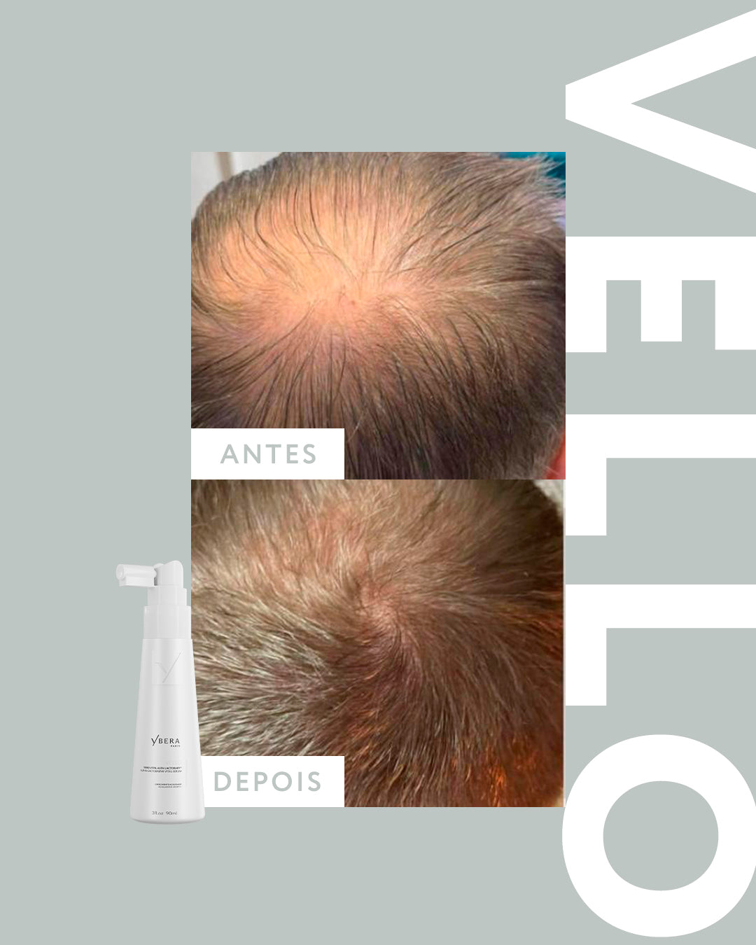 Vello ALFA-ACTOBABY® - Kit Shampoo 250ml + Máscara 200gr + Serum 90ml