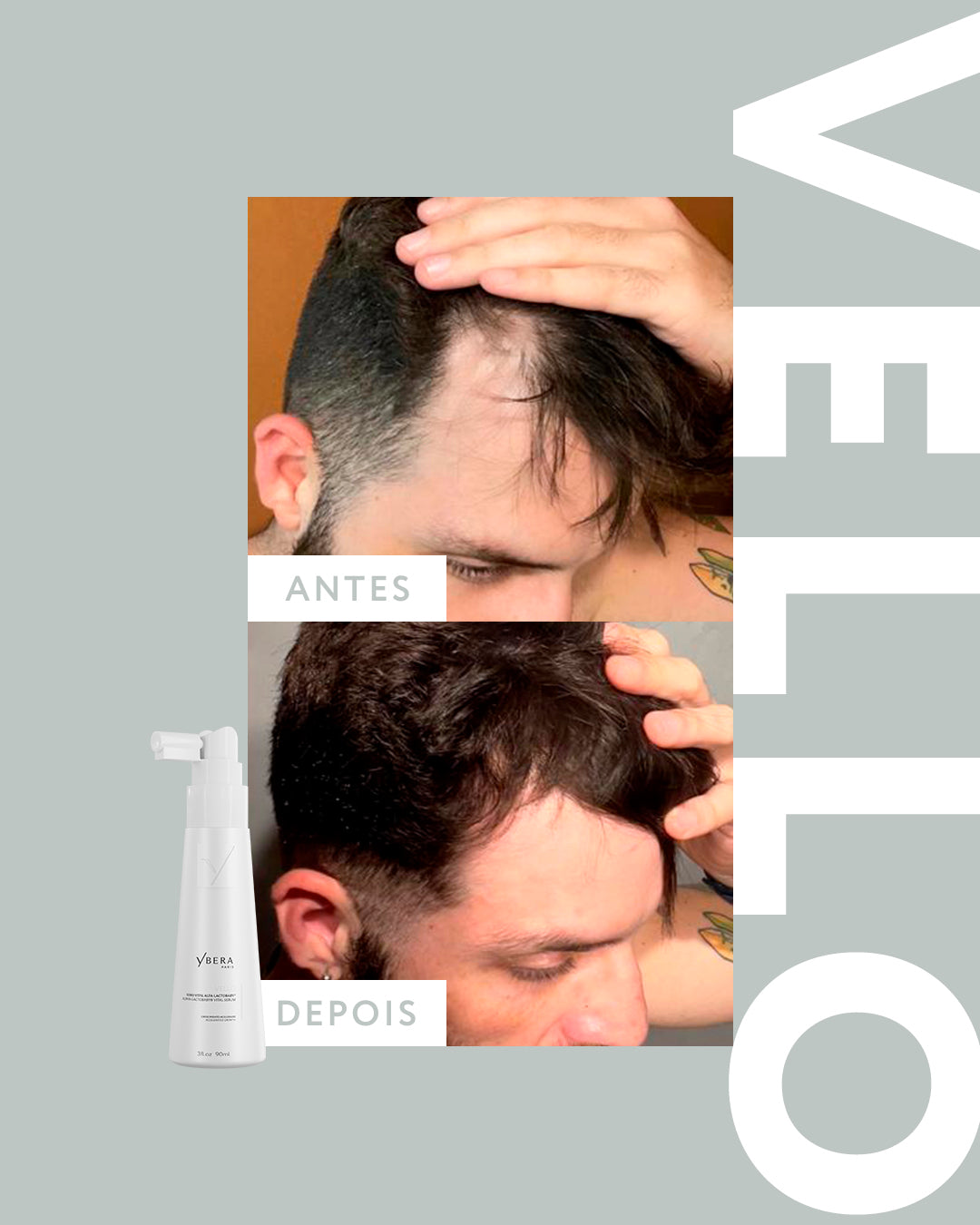 Vello ALFA-ACTOBABY® - Kit Shampoo 250ml + Máscara 200gr + Serum 90ml